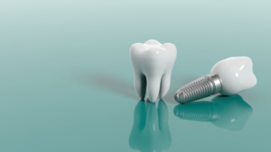 A dental replacement and dental implant resting on a counter